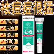祛痘膏祛痘凝膠舒緩學(xué)生青春痘去痘痘祛痘印閉口粉刺淡化痘印痘坑 五盒強效裝 香港東南亞草本祛痘膏20g一盒