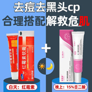 福元 紅霉素軟膏10g/支  紅霉素軟膏膿皰瘡潰面感染痘痘痤瘡皮膚化膿燙傷燒傷皮膚病感染 2盒裝【去痘去黑頭】贈(zèng)棉簽