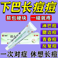 下巴長痘痘祛痘藥膏維A酸乳膏祛痘消炎痤瘡專用淡化痘印內(nèi)分泌失調(diào)調(diào)理男女臉上長痘痘修復消炎痘印閉口粉刺 1盒裝【下巴爆痘 一碰就疼】國藥對癥