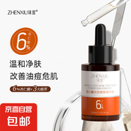 杏仁酸祛痘嫩膚精華液收斂毛孔粗大去痘痘閉口粉刺舒緩保濕原液 杏仁酸祛痘嫩膚精華液2瓶