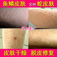 蛇皮肤霜去鱼鳞腿全身干燥脱皮起皮病润肤保湿滋润补水身体乳