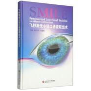 近視眼診治新技術叢書：飛秒激光小切口透鏡取出術SMILE