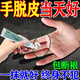 九福堂手脫皮用什么手脫皮嚴重脫皮真菌蛻皮干燥起皮手足癬真菌感染藥膏 1盒裝【手指頭脫皮】