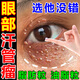 京珠堂汗管瘤眼部去除神器點(diǎn)眼周脂肪粒油脂粒扁平疣藥水男女通用膏 單盒裝
