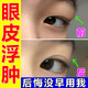 腫眼泡去脂消腫消除眼睛眼部脂肪厚上眼皮浮腫水腫紅腫熬夜眼腫上眼皮松弛提拉緊致眼部消脂貼大人小孩可用 組合強效裝【去腫效果一絕】