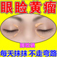 眼瞼黃瘤祛去除眼角瞼黃疣克星眼瞼板腺堵塞脂肪粒汗管瘤眼部黃斑凸起眼周白色黃色顆粒軟膏 買(mǎi)二發(fā)三【療程裝】只需兩盒價(jià)