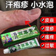【正品大藥房官方旗艦】濕疹止癢去根百毒膏止癢皮膚病皮膚瘙癢牛皮癬汗皰疹皮炎濕疹過(guò)敏苗藥膏王 買(mǎi)5+4【發(fā)9支升級款】
