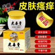 靈華山【虎毒膏】成人皮膚外用乳膏手足屁股腳癢脫皮大腿內(nèi)側(cè)癢膏皮琰 發(fā)3盒