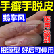 手癬特用傚藥手足癬真菌感染藥膏脫皮開(kāi)裂鵝掌風(fēng)汗皰疹抑菌膏手上起小水泡手干脫皮瘙癢專(zhuān)用藥硝酸咪康唑乳膏 3盒裝【瘙癢起泡脫皮干裂】
