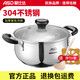 愛仕達（ASD）湯鍋304不銹鋼燉鍋大燃氣灶電磁爐奶鍋 加厚無涂層復底蒸鍋煮面鍋 雙耳鍋 20cm 3L