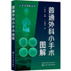 小手術(shù)圖解叢書(shū)--普通外科小手術(shù)圖解