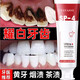 雅牙仕益生菌美白牙膏 口臭去黃去牙漬去煙漬去牙垢口腔異味牙齒亮白WS SP-4牙膏 120g 1支 去牙結i石上牙漬