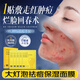仕月小燈泡祛痘面膜祛痘印修復(fù)淡化痘印痘坑修復(fù)男女補(bǔ)水保濕語(yǔ)速羽束 兩盒【急救專用】