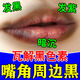 杰沐康唇周黑去除膏嘴角黑色素沉淀嘴唇暗沉淡化嘴角唇周發(fā)黑男女適用H 買二送一【3盒】