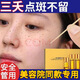 云南本草點斑藥水祛斑雀斑點斑專用美容院金水點祛斑遺傳雀斑否點痣膏水斑 1盒裝
