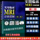 實用臨床MRI診斷圖解第2版 mri診斷與臨床讀片指南核磁共振書籍核磁共振成像診斷學磁共振成像診斷