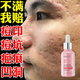 粉嫩公主 寡肽原液改善痘痘肌淡化男女精華液痘印痘疤痘坑安雷瓶特恩可搭配本店駐顏祛痘膏修護(hù)青春痘 寡肽原液 3瓶裝