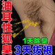 媛方去狐臭腋臭止汗露腋下異味噴霧吸汗貼根除男士女士專用油耳型噴劑 50毫升濃縮液1瓶（送1個體驗(yàn)裝）