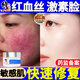 修正敏感肌修復(fù)面霜臉部泛紅紅血絲修復(fù)角質(zhì)層薄增厚激素紅高原紅保濕 單瓶裝【修護(hù)霜】