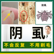 苗先鋒 陰虱男女士私處陰虱藥虱子藥林LD旦孕婦成人用藥去虱子膏陰虱硫磺噴劑百部酊祛除虱卵虱立凈噴霧 陰虱凈X1+專用護(hù)膏X1+內(nèi)褲X1+專用洗皂X1
