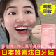SMILEKIT日本美白牙貼去牙黃變白速效去黃去牙漬去煙漬白牙貼片亮白美牙貼 2盒裝【實(shí)惠裝】
