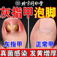 北京同仁堂灰指甲泡腳藥包真菌感染脫甲壞甲甲床分層增厚損傷腐臭傳染足浴包 買二送一【共三盒】周期裝