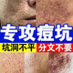 祛痘印淡化消除去痘痘和痘印痘坑修復(fù)男士凹洞填充再生黑色素沉淀 一盒【體驗(yàn)款】