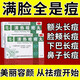 臉上去痘痘的藥】去閉口黑頭痤瘡粉刺 男女學(xué)生青春痘淡化痘印去背上下巴紅腫硬痘痘消炎藥 清熱暗瘡?fù)?三盒一個療程【滿臉都是痘】