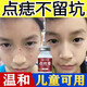點(diǎn)痣膏無(wú)痕正的品 無(wú)痛兒童可用臉部點(diǎn)痦子去黑痣祛淡斑專(zhuān)用點(diǎn)痣美容修復(fù)液神器儀祛斑點(diǎn)痣點(diǎn)疣藥水艦旗官方 修復(fù)液+點(diǎn)痣膏組合裝