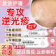逆光疹去閉i口粉刺克星小孩臉上長(cháng)硬疙瘩丘疹額頭上長(cháng)小粒痘痘有炎癥的樣子修復皮膚屏障祛痘除螨去除藥膏醫 逆光疹閉口粉刺專(zhuān)用膏