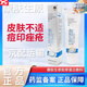 【藥房直售】康膚生原膠原蛋白敷料凝膠30g官方皮i炎過(guò)敏性軟膏祛痘印玫瑰痤i瘡皮i炎蛋白敷料 兩盒裝