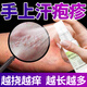 汗皰疹用藥手上起小水泡脫皮手癢 消炎止癢藥膏抗真菌脫皮瘙癢難忍真菌感染效 鹽酸特比萘芬噴霧劑 1盒【汗皰疹 真菌感染】