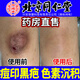 怡福壽北京同仁堂去除痘印黑色素疤痕印膏去除淡化疤黑印色素沉淀著修復(fù) 單盒體驗(yàn)裝