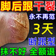 香港大藥房腳后跟干裂膏 真菌感染腳干裂脫皮開(kāi)裂防裂保濕滋潤足霜w1 買(mǎi)二贈一【包冶好不覆發(fā)】