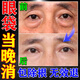 歐誘眼霜去眼袋嚴重眼袋消除重度大眼袋專(zhuān)用女男士中老年祛除神器正品 單盒裝 眼貼膜去眼紋膠原蛋白最好的眼霜