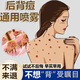 背上長痘痘祛痘可搭藥毛囊炎真菌感染螨蟲雞皮膚前胸后背粉刺紅點(diǎn)長滿膿包瘙癢后背長痘噴霧 買二發(fā)三【療程裝】手臂脖子長痘痘