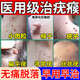 維a酸乳膏去疣絲狀疣跖疣脖子頸部專(zhuān)用藥去疣醫用去疣膏扁平疣專(zhuān)用藥疣瘊靈去除脖子小肉粒扁平疣特皮膚用藥 1盒【維a酸乳膏去疣絲狀疣跖疣脖子頸部專(zhuān)用藥】 維a酸乳膏去疣醫用去疣膏扁平疣-皮膚用藥 非處方藥