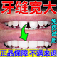 葵花牙縫寬大輔助修復神器牙間隙大牙齦萎縮牙膏牙根外漏牙齒松動(dòng)矯正 買(mǎi)二送一【免費試用】發(fā)3盒