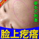 懷南堂逆光疹小孩臉上起疙瘩皮膚有雞皮長(cháng)粉刺脂肪粒止癢專(zhuān)用兒童軟膏 單盒裝【30g】建議周期使用