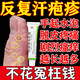汗皰疹藥膏手上起小水泡脫皮很癢 皮膚瘙癢皮炎濕疹真菌感染手癢手指鉆心癢脫皮止干裂抑菌癢膏阿昔洛韋乳膏 5盒【真菌感染 反復(fù)汗皰疹】
