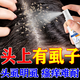 虱子藥小女孩頭發(fā)有虱卵虱立凈頭長虱子頭虱藥兒童頭虱蟲卵百部酊 1瓶裝【短發(fā)】