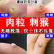 瘊疣膏猴子去除藥膏刺猴專用的藥刺猴子尋常疣去瘊疣根專用藥膏魚鱗痣跖疣小肉粒疙瘩特治療效藥維a酸乳膏 2盒裝【嚴重大面積猴子肉粒疣瘊】只需一摸無痛脫落