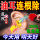 油耳朵清潔器治療兒童中耳炎清理耳癢油耳耵聹軟化專(zhuān)用滴耳液克星 單盒【藥房直發(fā)】