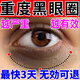 艾頤葆黑眼圈去除男士女士去黑眼圈去除神器熬夜眼貼膜提拉緊致淡化細紋 一盒裝【淡化黑眼圈】