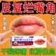 日本口角炎爛嘴角可搭藥兒童專(zhuān)用嘴角潰爛干裂疼痛上火脫皮起泡慢性唇炎修復軟潤唇膏 單盒體驗裝（兒童可用）