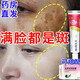 維A酸乳膏 班麗祛斑凈參棘i軟膏國藥準字otc正品改善黃褐斑祛斑專用藥祛斑點斑專用藥水老年斑 1乳膏【推薦多盒療程使用】