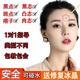 【美容院同款】祛點黑痣膏臉部液筆凸痣晤子雀斑黑點志神器 一套裝【點志膏+修復液】