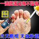伈至誠(chéng)跖疣專(zhuān)門(mén)用藥跖疣腳底趾疣去i根雞眼hpv專(zhuān)門(mén)用藥繭去疣體100%藥膏 特效3盒100%包冶好】醫(yī)師推薦