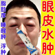 久久町上眼皮去浮腫消腫水腫腫眼泡睡醒眼腫去浮腫眼皮厚眼皮松弛提拉膏 1盒【無(wú)優(yōu)惠】