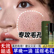 南京同仁堂收縮毛孔精華液閉口粉刺克星毛孔粗大油脂去黑頭修護復(fù)細致爽膚水 1瓶裝【專攻黑頭粉刺細膩毛孔】